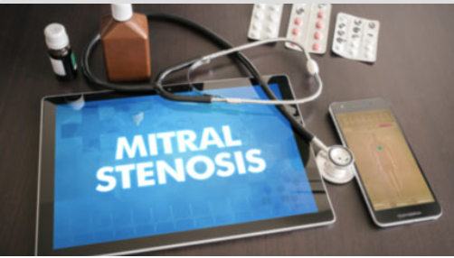 Mitral Stenosis Top 10 | Online Learning